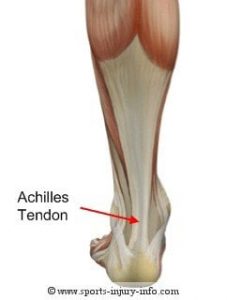 articulațiile tendonului piciorului și tratamentul acestora Sunt articulații tinere rănite