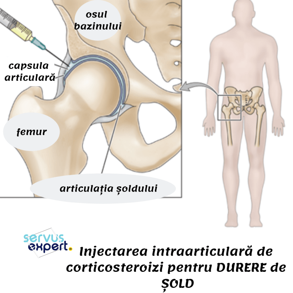 injecții pentru dureri severe în articulația șoldului