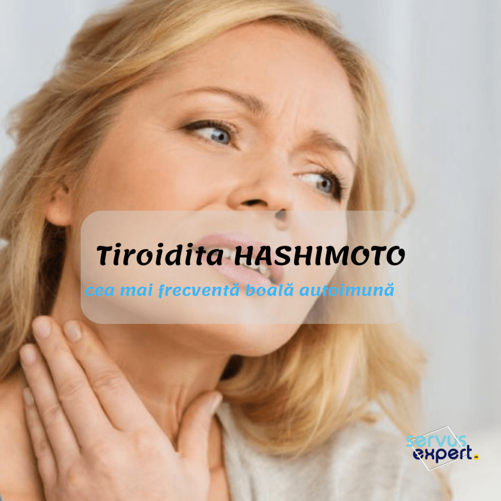 inflamație articulară în hipotiroidie