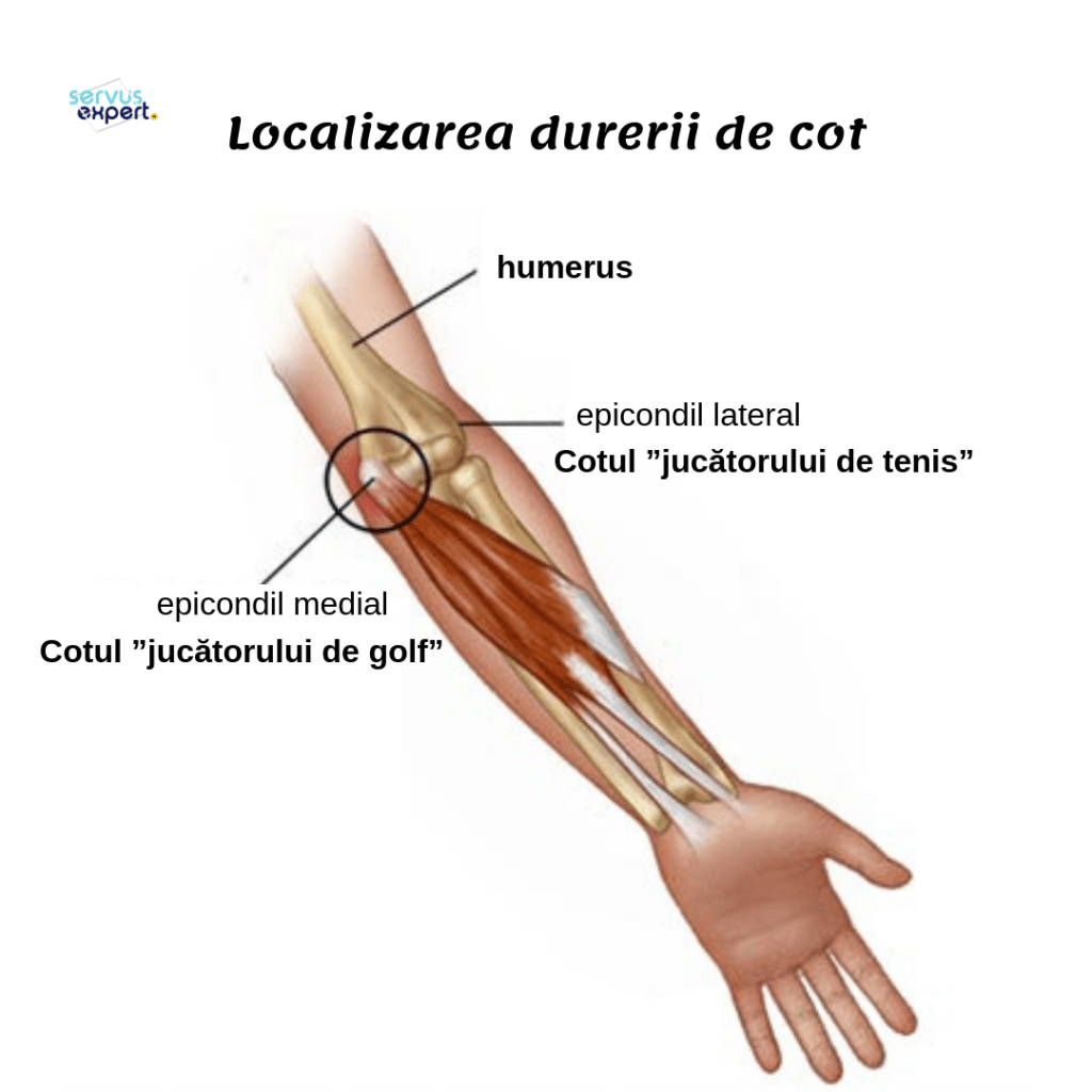 dureri la nivelul articulațiilor brațului)