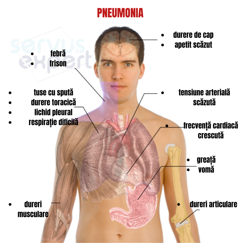 pneumonie dureri articulare)