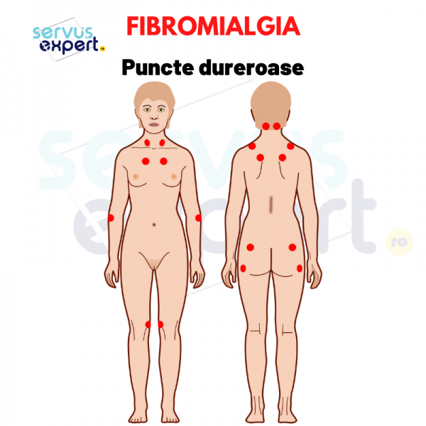 dureri articulare fibromialgie