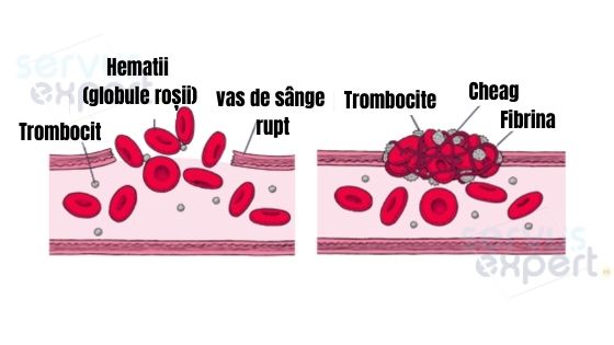 trombocitele sunt crescute în varicoza dumping venele în varicoza