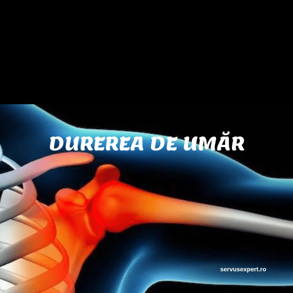 cum să alinați nevralgia durerii de umăr cauzele durerii la nivelul articulațiilor și coloanei vertebrale