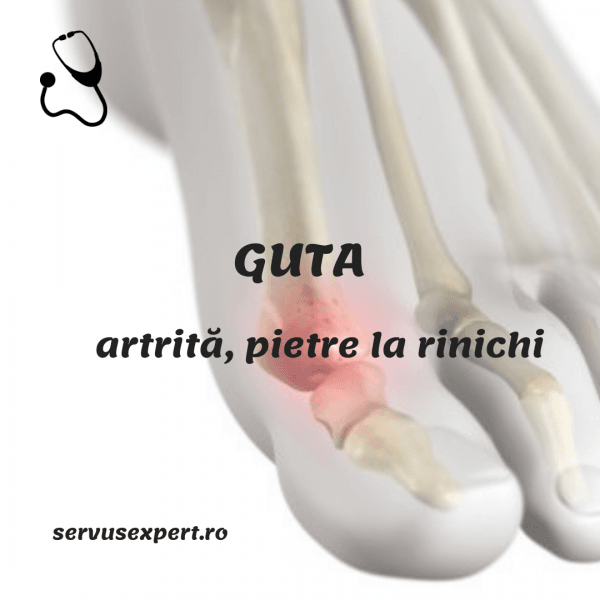 artrita guta in brate
