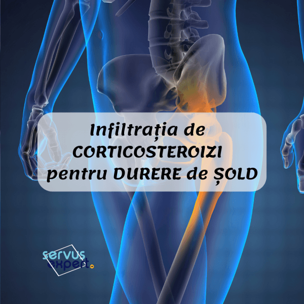 corticosteroizi pentru dureri articulare