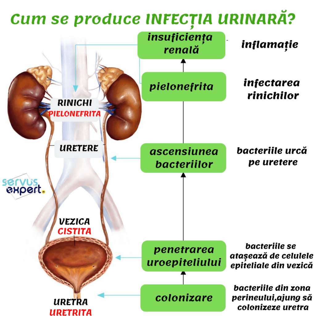 infectie urinara recidivata sau repetata