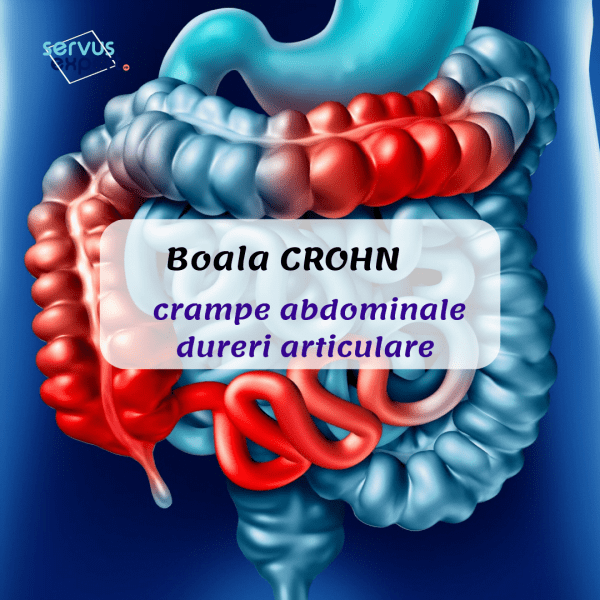 Durerea articulară a bolii Crohn)