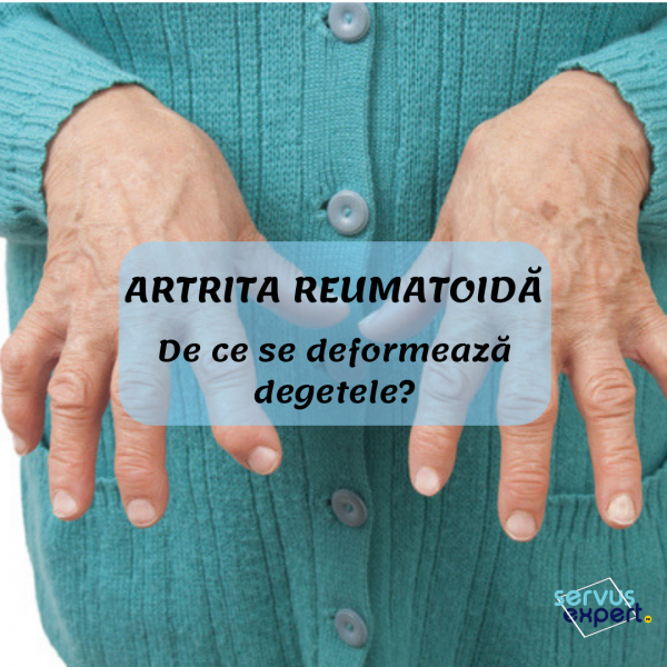 artrita reumatoidă a bolii mâinii umane