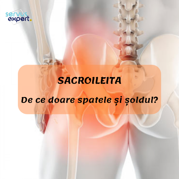 Disfuncţia articulaţiei sacroiliace (Sacroileita) : aer-bucuresti.ro