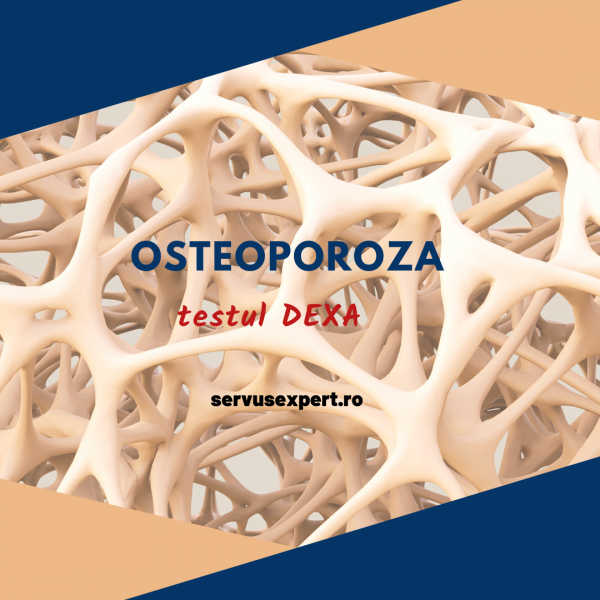 test pentru osteoporoza