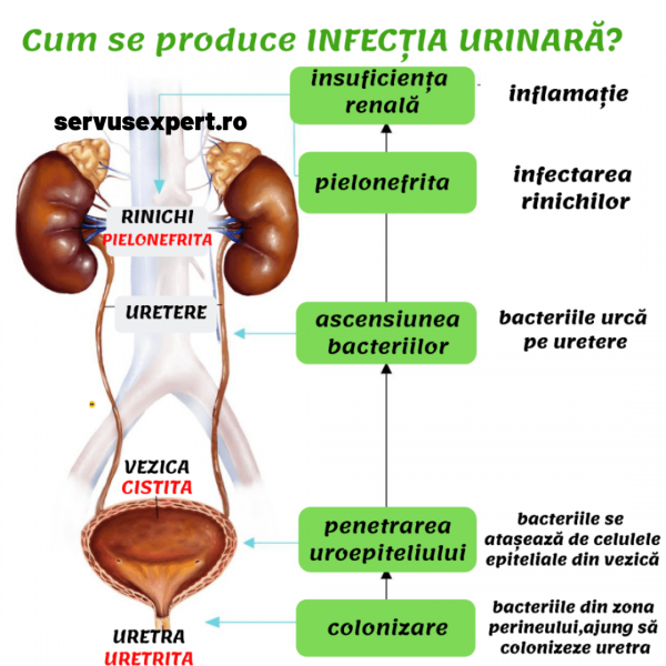 infecția urinară la femei