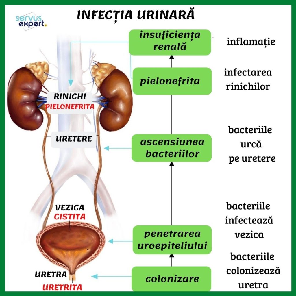 infectie urinara