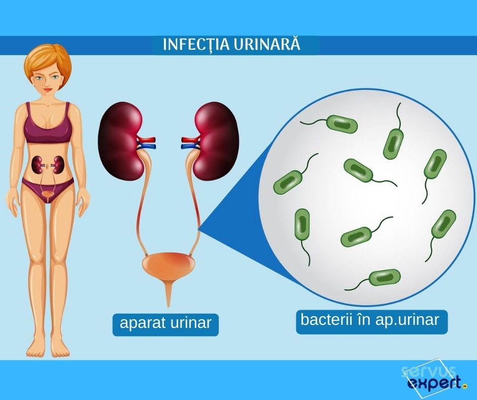 bacterii vezica urinara)