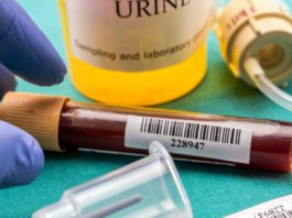 urina cu sange sau hematuria