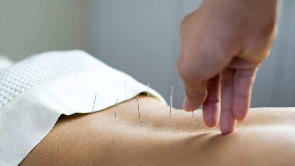 acupunctura pentru durere nerv sciatic